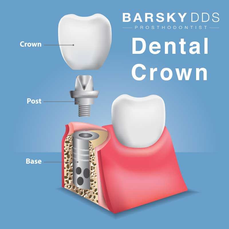 parts of a tooth diagram