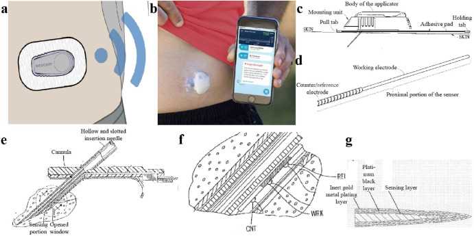 dexcom g6 parts diagram